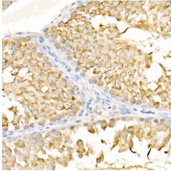 KIF3A Antibody - BSA Free