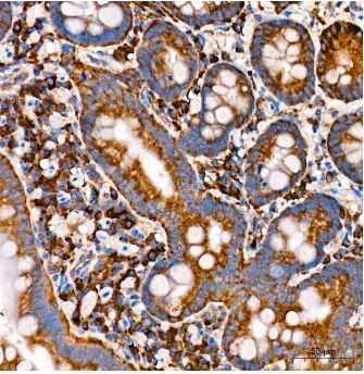 CHAC1 Antibody - Azide and BSA Free