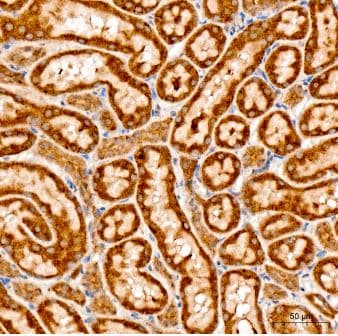 CHAC1 Antibody - Azide and BSA Free