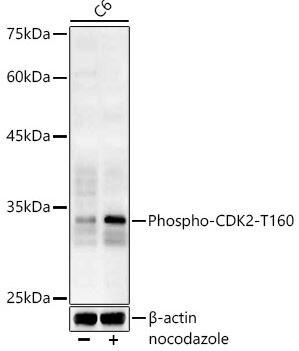CDK2 [p Thr160] Antibody