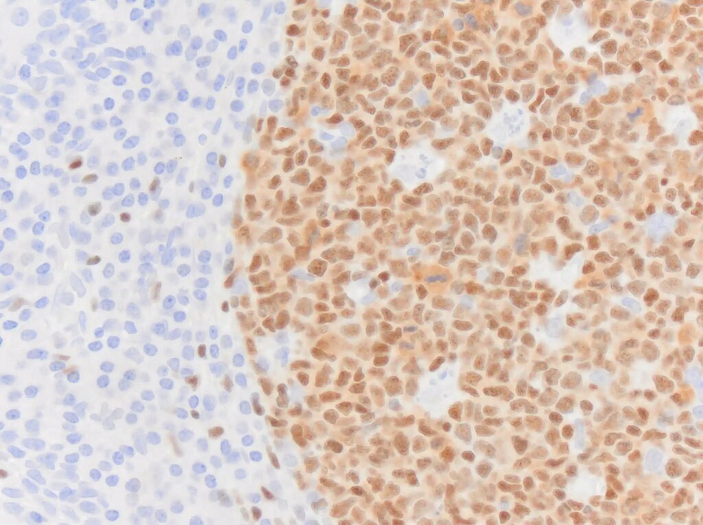 Pax5/BSAP Antibody (PAX5/3735)