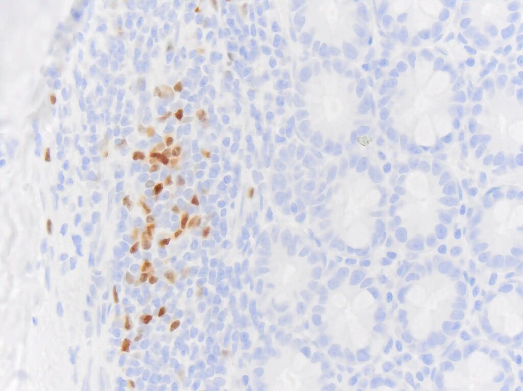 Pax5/BSAP Antibody (PAX5/3735)