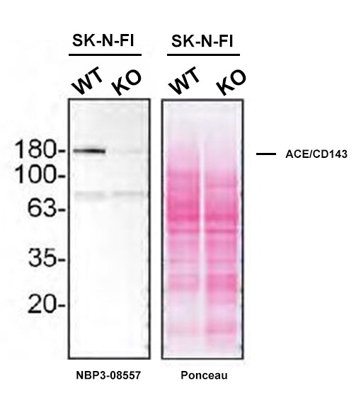 ACE/CD143 Antibody (ACE/3762) - Azide and BSA Free