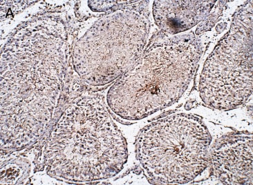IFI27 Antibody Immunohistochemistry: IFI27 Antibody [NBP3-12400]