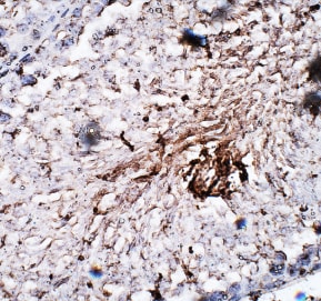 IFI27 Antibody Immunohistochemistry: IFI27 Antibody [NBP3-12400]