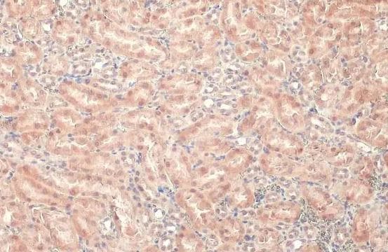 LASS2 Antibody