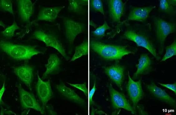 TOR/mTOR [p Ser2448] Antibody