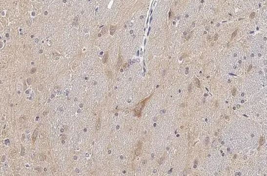 Tau [p Thr217] Antibody
