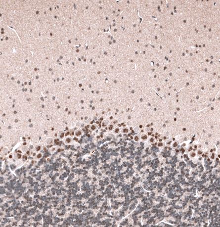 GLI-1 Antibody (CL12191)