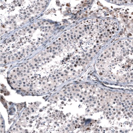 GLI-1 Antibody (CL12191)