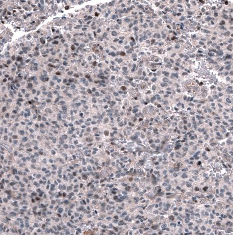 GLI-1 Antibody (CL12191)