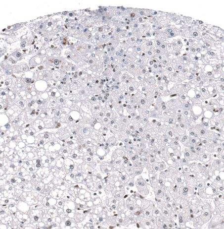 GLI-1 Antibody (CL12191)