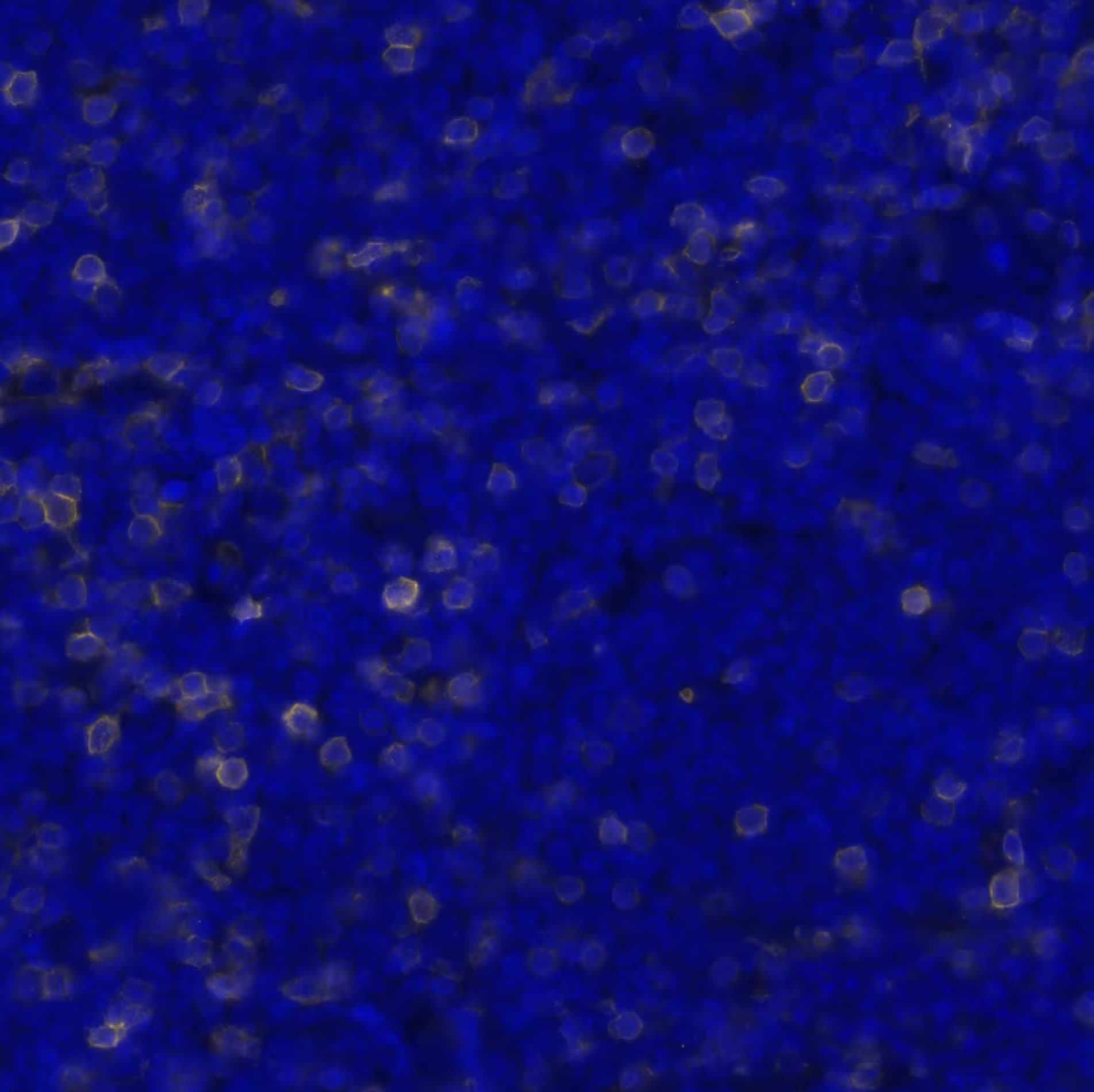 CD5 Antibody (CL12334) - BSA Free Detection of CD5 in Human Mantle Cell Lymphoma via seqIF™ staining on COMET™