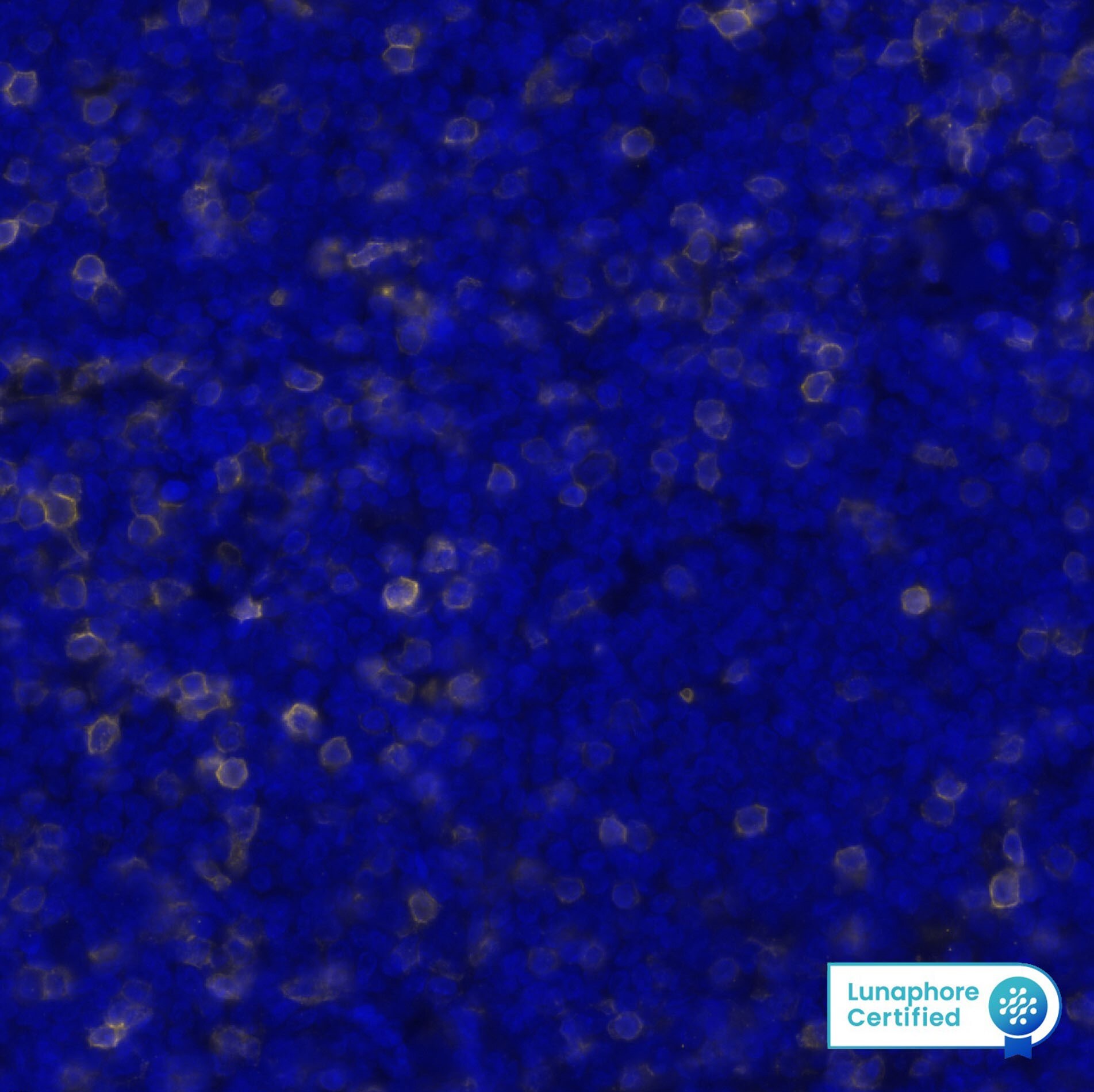CD5 Antibody (CL12334) - BSA Free Detection of CD5 in Human Mantle Cell Lymphoma via seqIF™ staining on COMET™