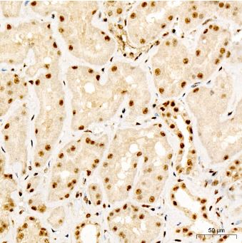 Smad2 [p Ser467] Antibody - Azide and BSA Free