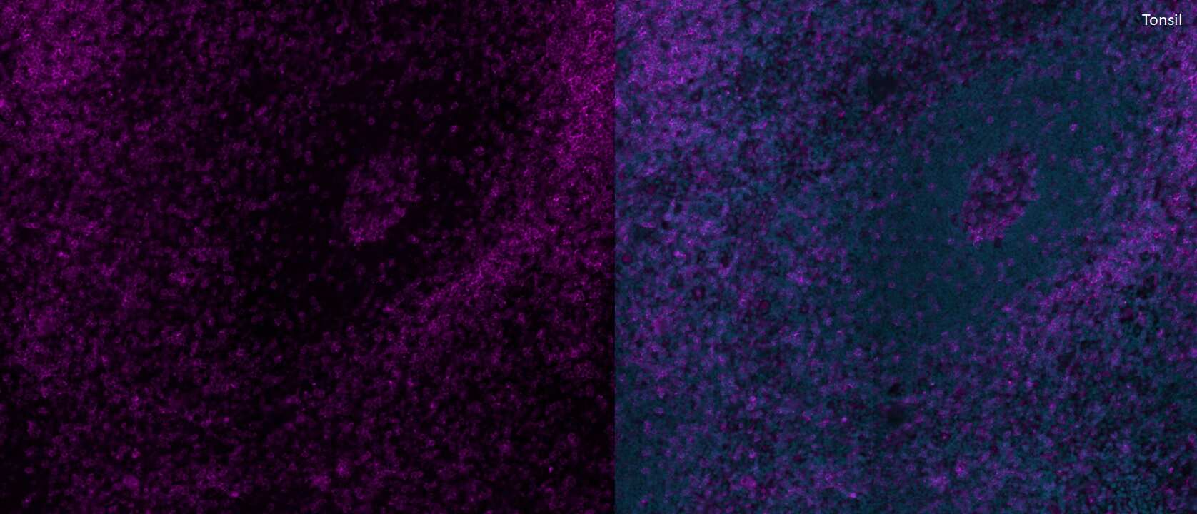 CD4 Antibody