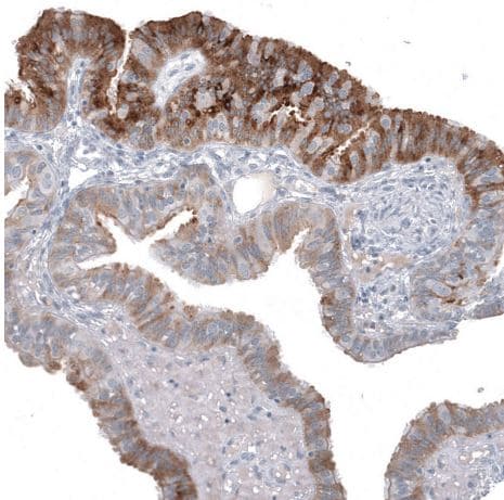 HE4/WFDC2 Antibody (CL12917)