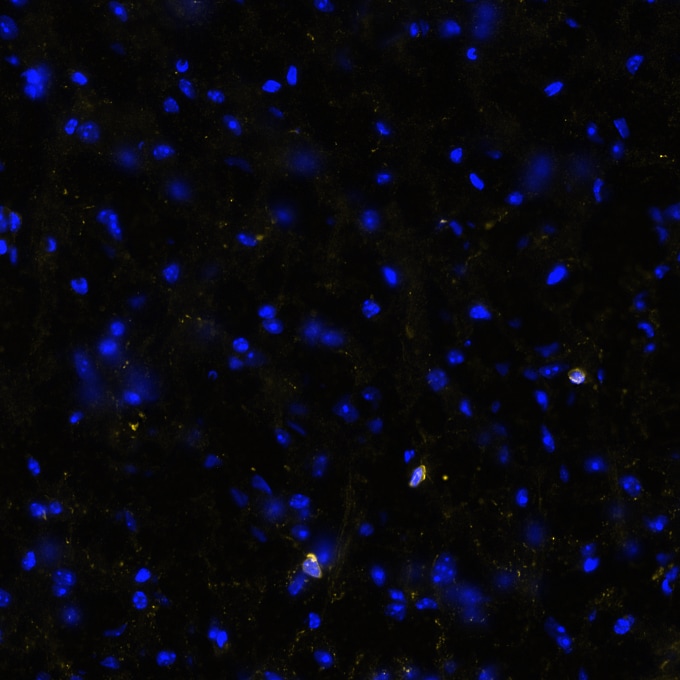 STING/TMEM173 Antibody (2922D) - BSA Free Multiplex Immunofluorescence: STING/TMEM173 Antibody (2922D) - BSA Free [NBP3-18816] -