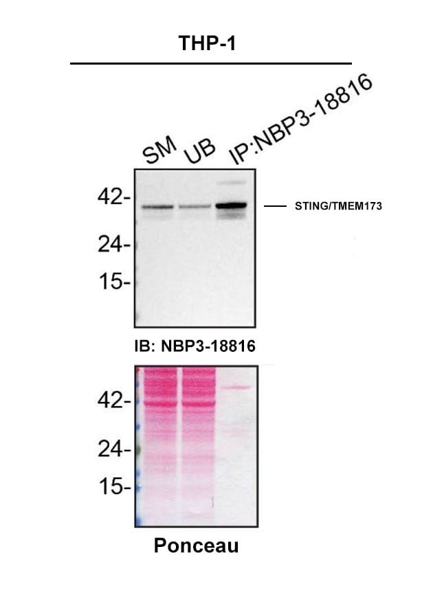 STING/TMEM173 Antibody (2922D)