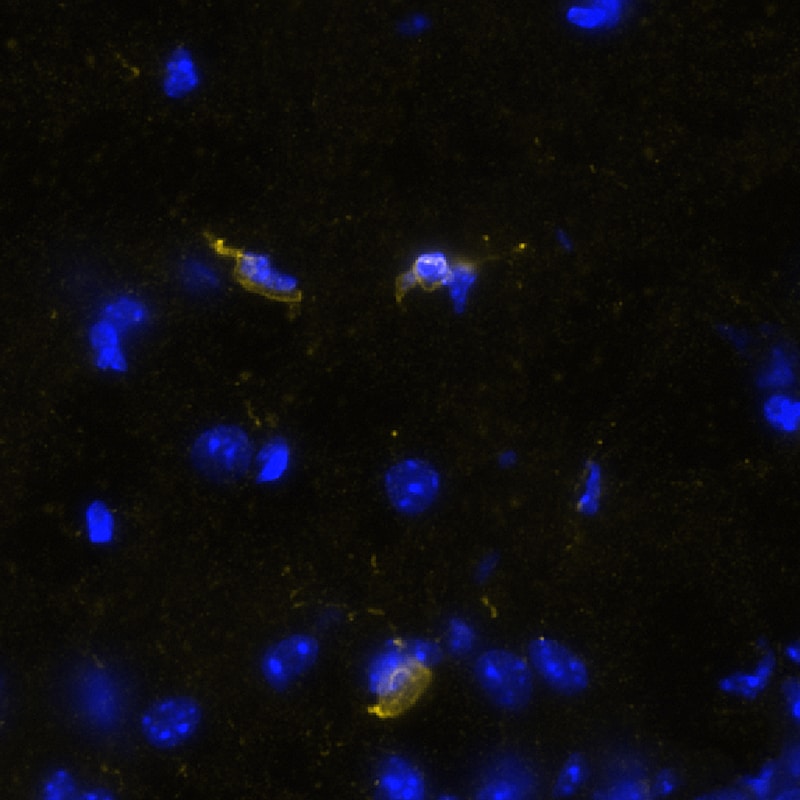 STING/TMEM173 Antibody (2922D) - BSA Free Multiplex Immunofluorescence: STING/TMEM173 Antibody (2922D) - BSA Free [NBP3-18816] -