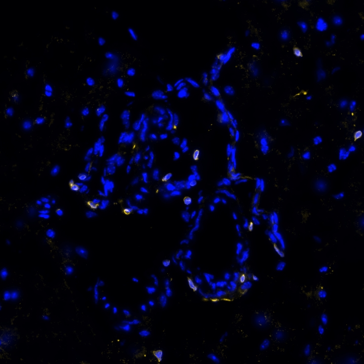 STING/TMEM173 Antibody (2922D) - BSA Free Multiplex Immunofluorescence: STING/TMEM173 Antibody (2922D) - BSA Free [NBP3-18816] -