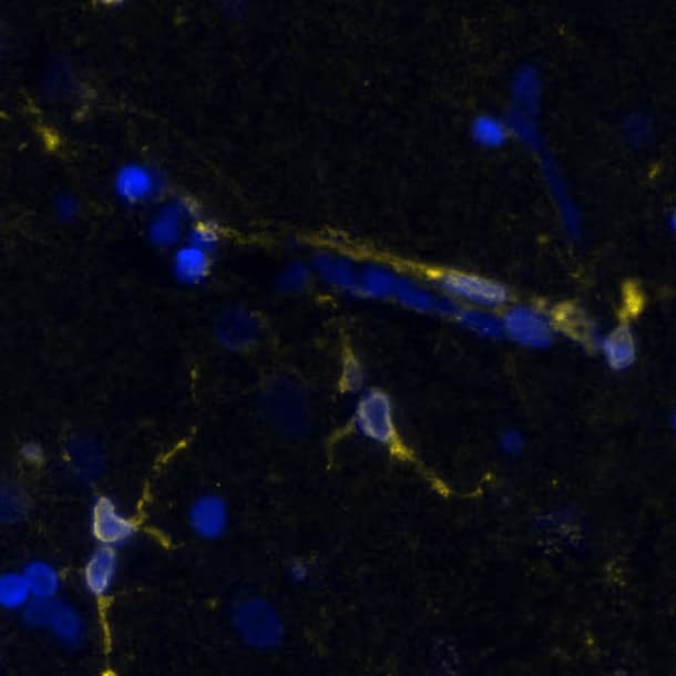 STING/TMEM173 Antibody (2922D)