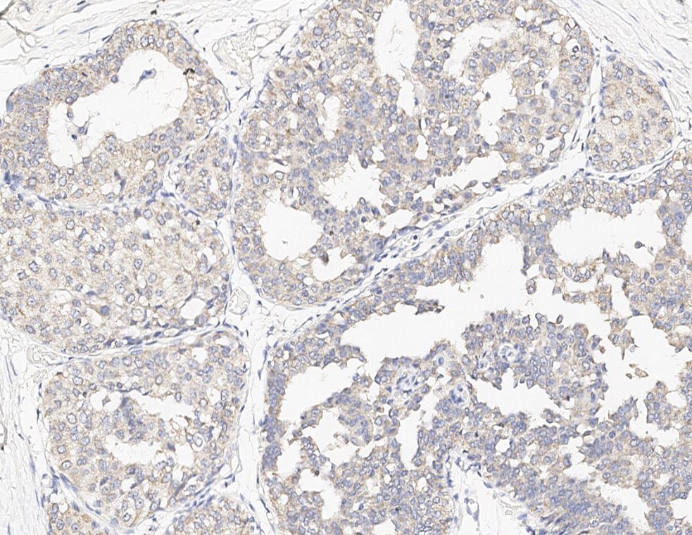 SMPDL3A Antibody - Azide and BSA Free