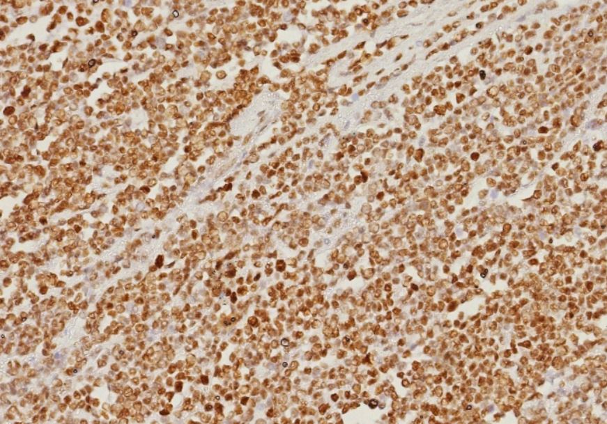 PMS2 Antibody (PMS2/8374R)
