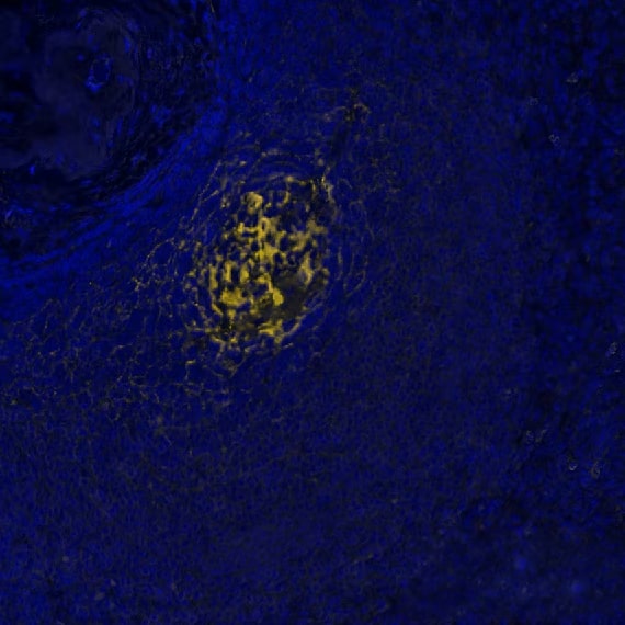 CD21 Antibody (CR2/7185R) CD21 Antibody (CR2/7185R)