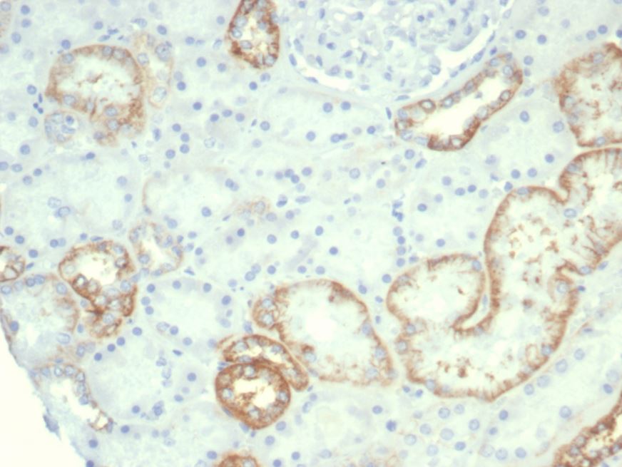 Cadherin-16 Antibody (rCDH16/7342)
