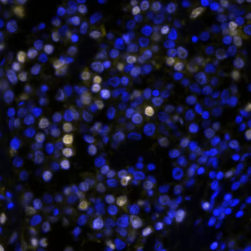 IRF4 Antibody (MUM1/8274R) IRF4 in Human Hodgkin’s Lymphoma via seqIF™ staining on COMET™