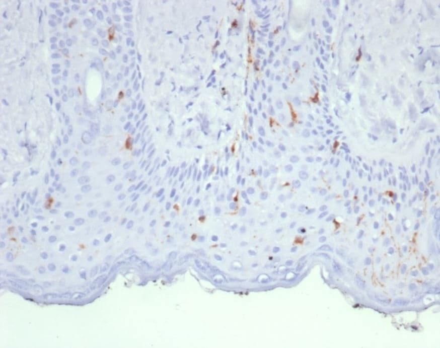 Langerin/CD207 Antibody (LGRN/7430)