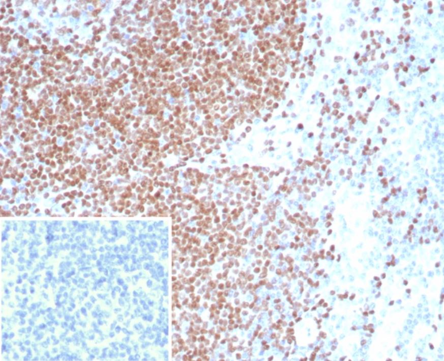 Pax3 Antibody (PAX3/8426)
