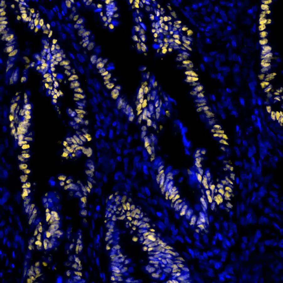 p53 Antibody (BP53-12) - IHC-Prediluted p53 Antibody (BP53-12)
