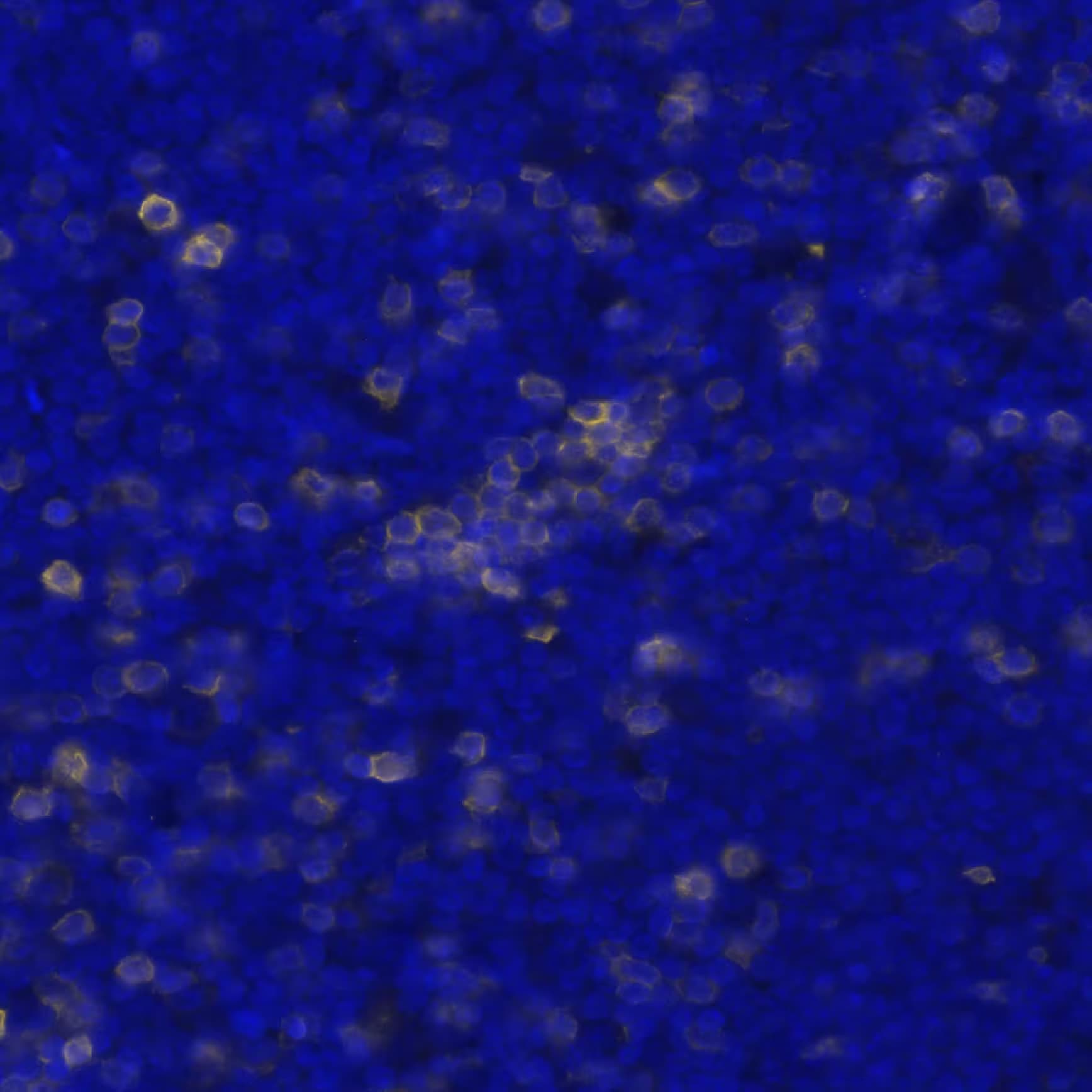 CD5 Antibody (CL12420) - BSA Free Detection of CD5 in Human Mantle Cell Lymphoma via seqIF™ staining on COMET™