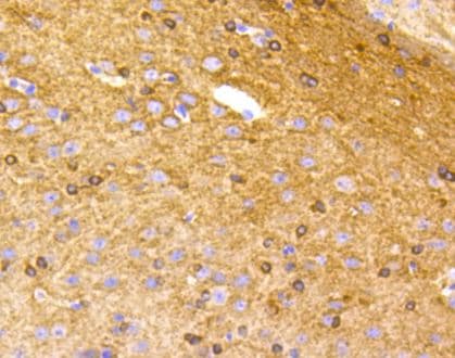 Tau [p Ser396] Antibody (SN62-09)