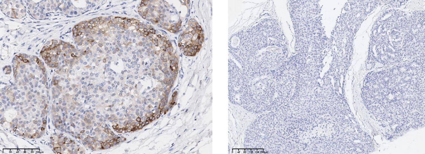 AKT1 [p Ser473] Antibody (0113)