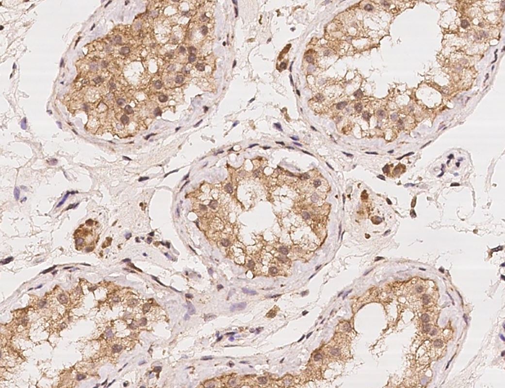 LIAT1 Antibody