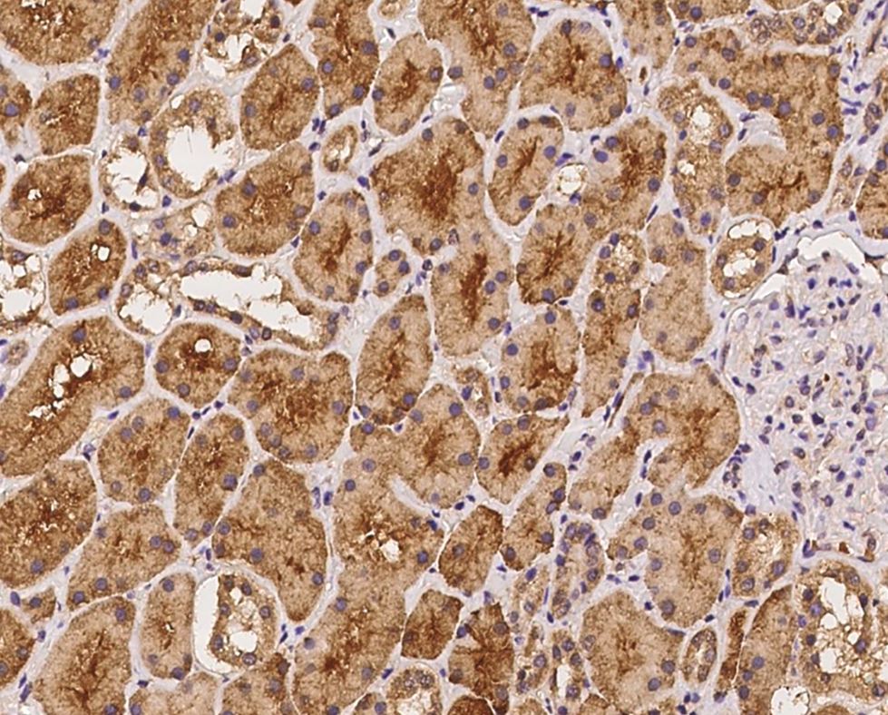 LIAT1 Antibody