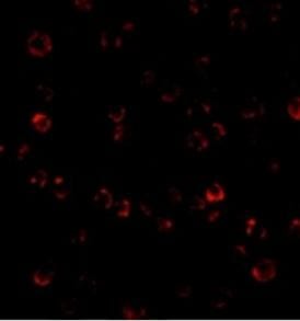 TEM8/ANTXR1 Antibody - BSA Free