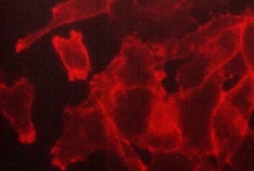 FXYD5/Dysadherin Antibody (M029)