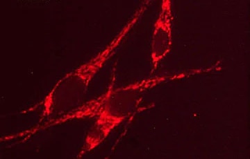 Mitofilin Antibody (M027)