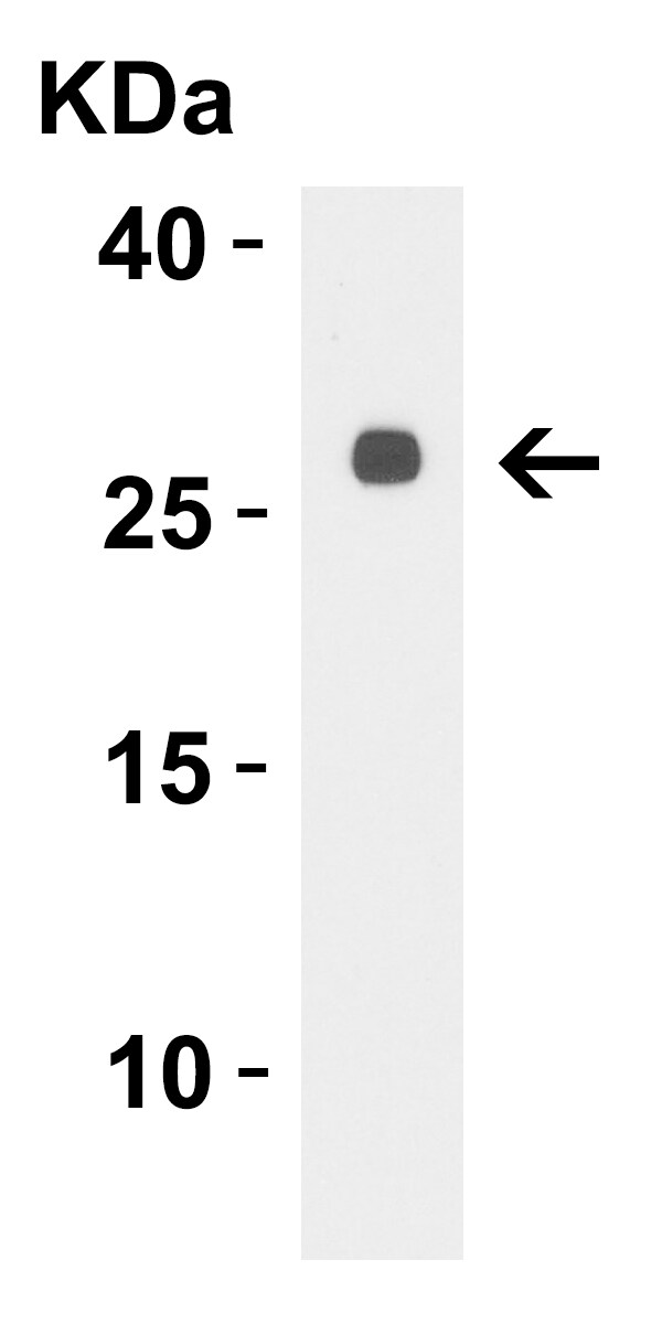 LpxT Antibody - BSA Free