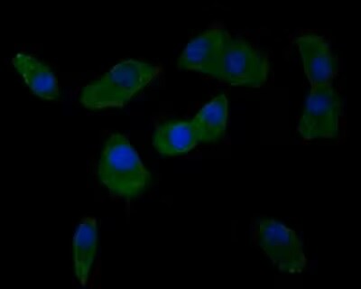 Integrin alpha V/CD51 Antibody (SC56-07)