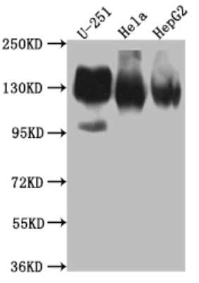 Integrin alpha V/CD51 Antibody (5G3)