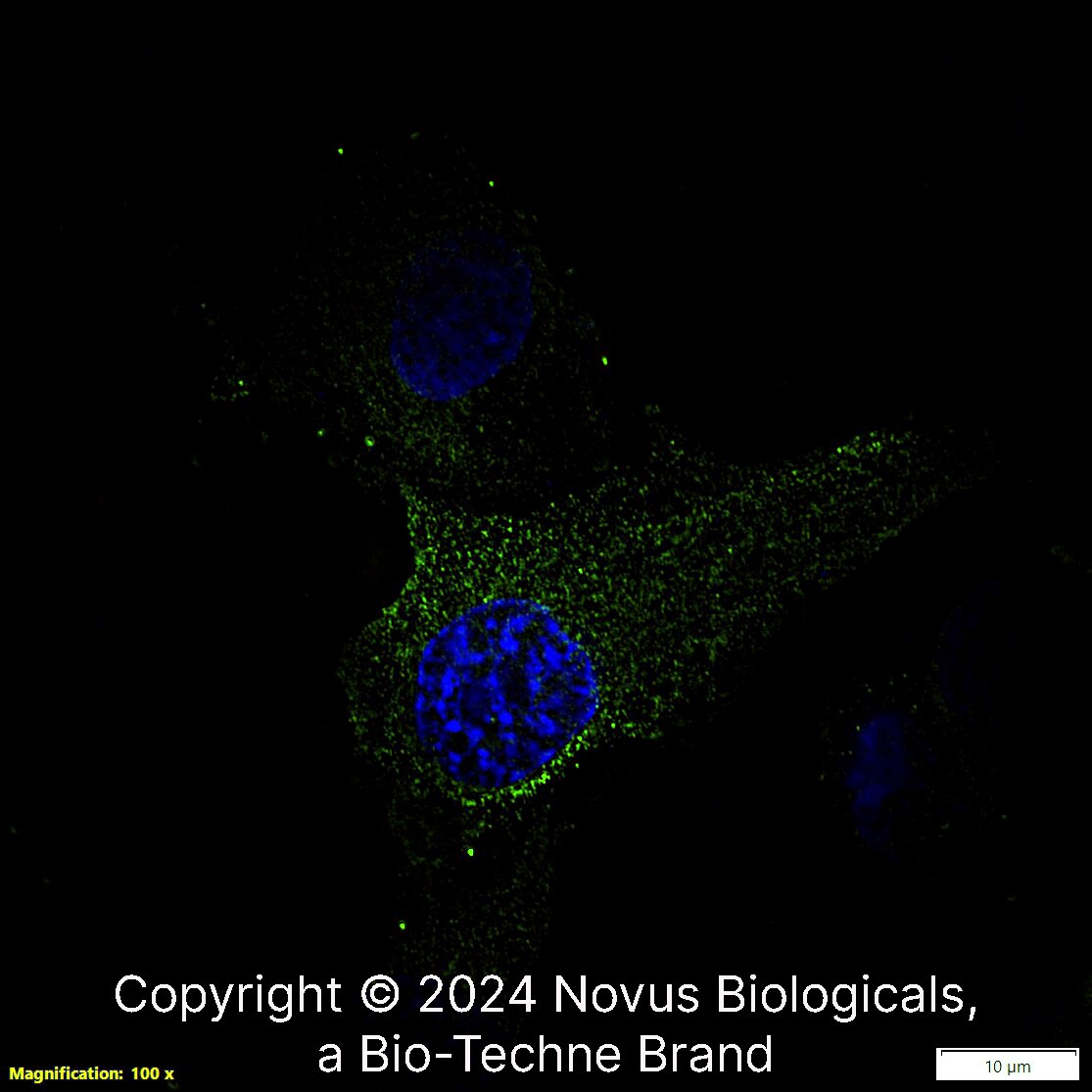 Optineurin Antibody Immunocytochemistry Staining of Optineurin in U-87 MG Human Cell Line