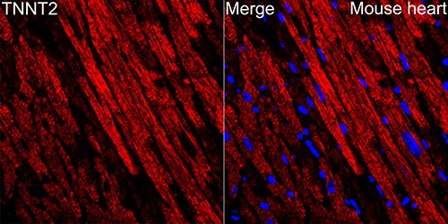 Cardiac Troponin T Antibody (10H9D8)