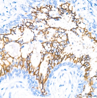 Aquaporin-4 Antibody (5A4W4)