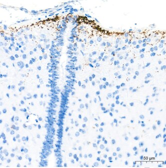 GnRH Antibody - BSA Free