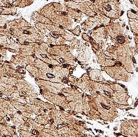beta Sarcoglycan Antibody